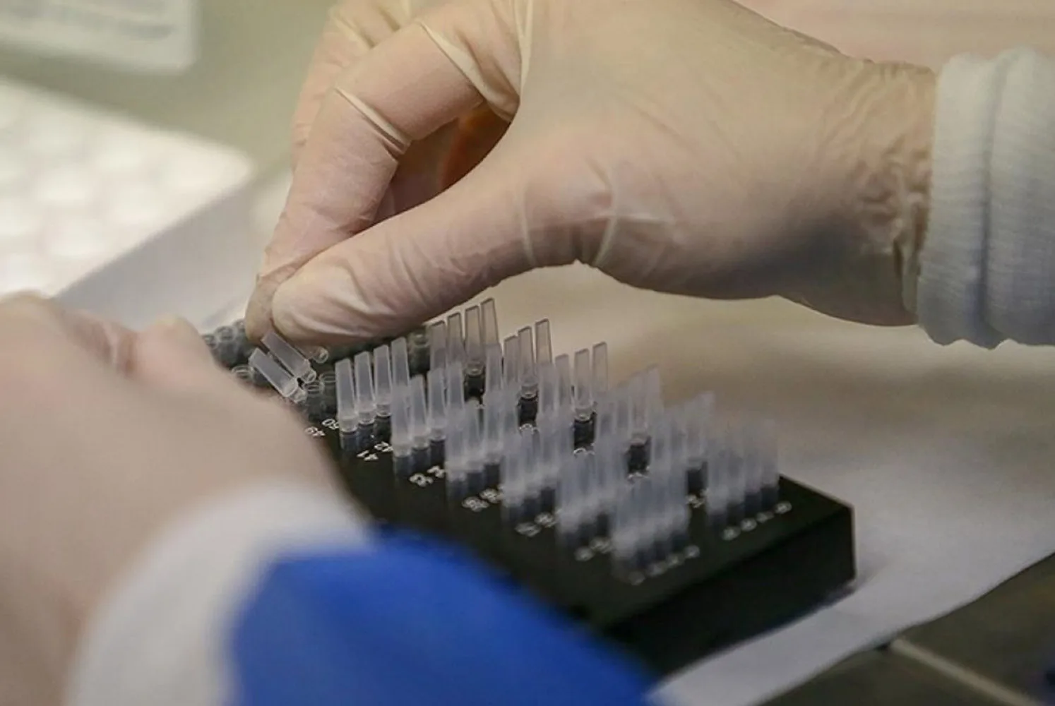 “1998 yılından önce doğanlar mutlaka test yaptırsın”