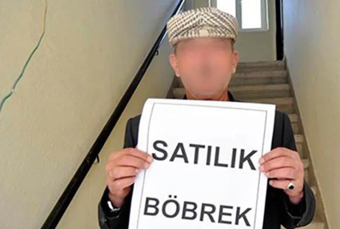 Sosyal medyada böbrek satışı!