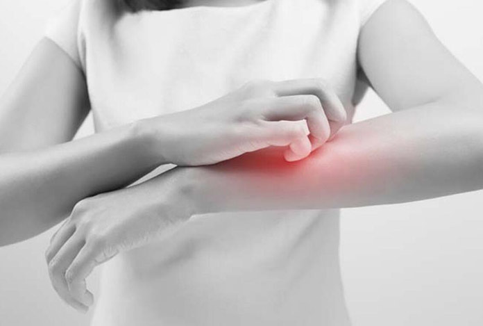 Covid-19’un yeni belirtisi: Kaşıntınız varsa…