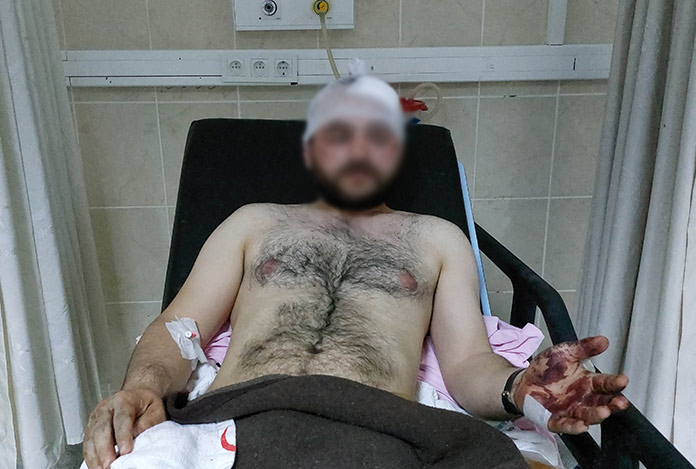 Aile kavgasını kana bulamıştı…