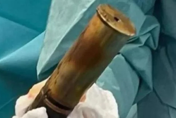 Anüsüne top mermisi sıkışan kişi acile gitti, hastane tahliye edildi