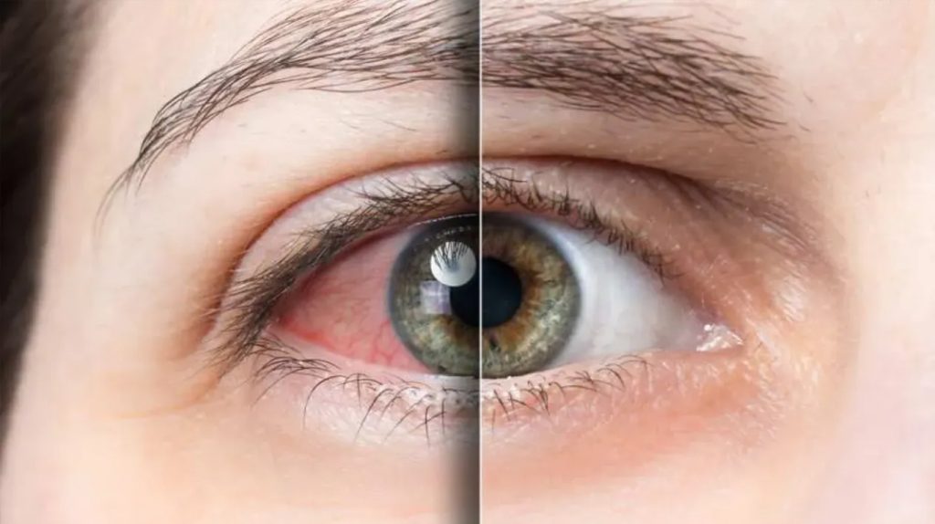 Göz sağlığını bozan hatalı alışkanlıklar