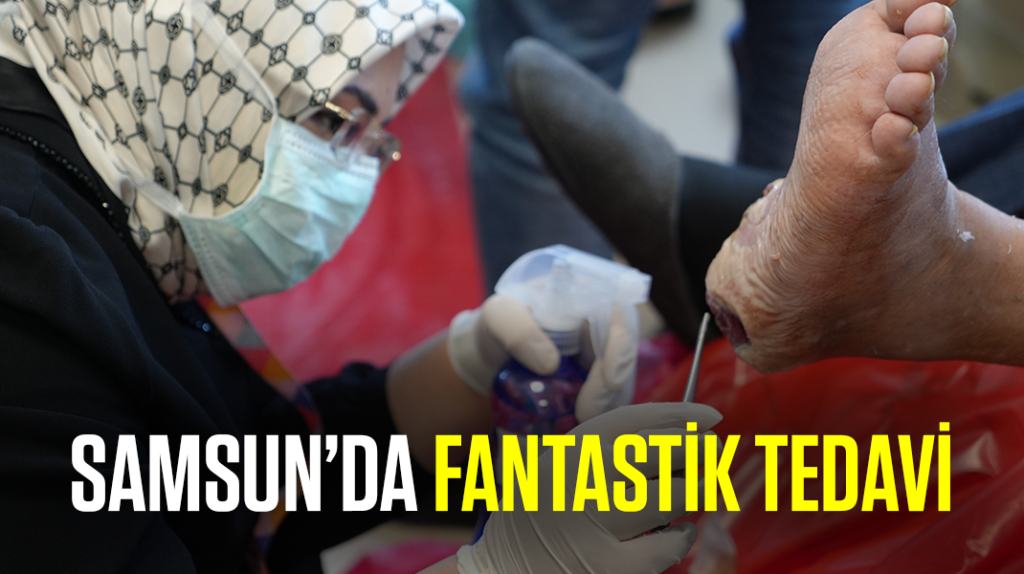 Samsun’da fantastik tedavi